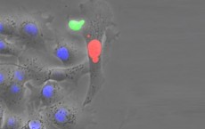 HBV-Specific T-Cell in Action (IMAGE)