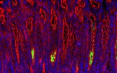 Gastric Epithelium with Helicobacter Pylori (IMAGE)