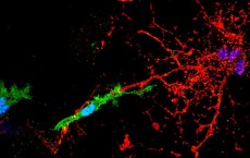 Microglial Cell Attacks Myelinated Axon (IMAGE