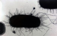 Escherichia Coli (IMAGE)