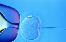 IVF 