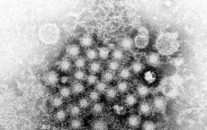 Hepatitis virion