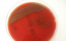 Colonies of S. tigurinus on Sheep Blood Agar