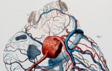 Study examines stent implantation compared to initial medical therapy for stable coronary disease