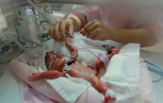 Premature Aging of Placenta Linked to Preterm Births