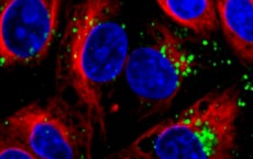 nanoparticles that can deliver short strands of RNA (green) into cells 