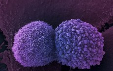 New drug stops rushing cancer cells, slow and steady healthy cells unharmed