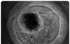 iPS Inside of a 3-D Fibrin Scaffold