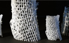 3D-printed bone scaffolding, created by BIO-SCAFFOLDS.