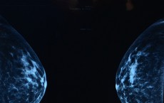 A former mammogram technician in Georgia put the lives of women in jeopardy.