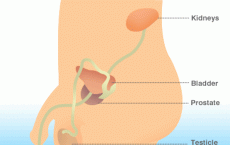 High Levels of Cholesterol and Triglycerides Ups Risk of Prostate Cancer Recurrence