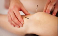 Acupuncture Does Not Improve Chronic Knee Pain in Older Adults